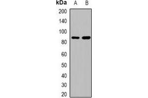 Western blot analysis of Beta Amyloid expression in HEK293T (A), Hela (B) whole cell lysates.
