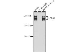 Immunoprecipitation analysis of 200 μg extracts of Jurkat cells using 3 μg CD45 antibody (ABIN6130077, ABIN6146454, ABIN6146456 and ABIN6213826).