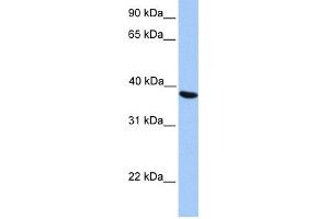 WB Suggested Anti-NAT6 Antibody Titration:  0. (NAT6 anticorps  (C-Term))