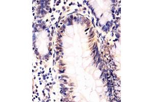 (ABIN652035 and ABIN2840509) staining SOX10 in human colon tissue sections by Immunohistochemistry (IHC-P - paraformaldehyde-fixed, paraffin-embedded sections).
