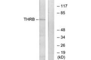 Western blot analysis of extracts from NIH-3T3 cells, using THRB Antibody. (THRB anticorps  (AA 391-440))