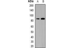 Western blot analysis of SATB1 expression in THP1 (A), mouse thymus (B) whole cell lysates. (SATB1 anticorps)