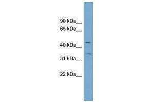SLC39A8 antibody used at 1 ug/ml to detect target protein. (SLC39A8 anticorps)