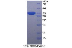 SDS-PAGE analysis of Human STAT1 Protein. (STAT1 Protéine)
