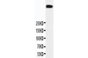 Anti-DNA PKcs antibody, Western blotting WB: HELA Cell Lysate