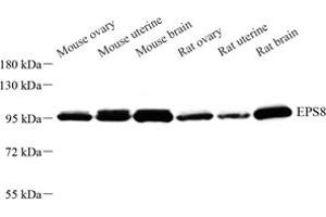 Western blot analysis of EPS8 (ABIN7073852) at dilution of 1: 500 (EPS8 anticorps)