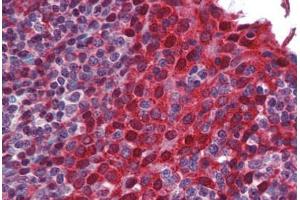 Human Tonsil: Formalin-Fixed, Paraffin-Embedded (FFPE)