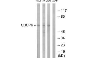 Western Blotting (WB) image for anti-ATP/GTP Binding Protein-Like 4 (AGBL4) (C-Term) antibody (ABIN1851213) (AGBL4 anticorps  (C-Term))