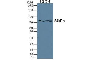 Figure. (PFKP anticorps  (AA 553-753))