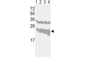 Western blot analysis of PGP9.