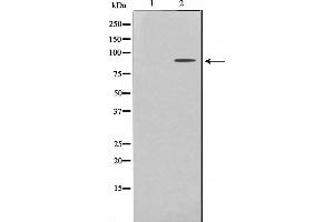 Western blot analysis on HeLa cell lysate using ES8L2 Antibody,The lane on the left is treated with the antigen-specific peptide. (EPS8-Like 2 anticorps  (N-Term))