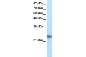 Western Blotting (WB) image for anti-Ring Finger Protein 114 (RNF114) antibody (ABIN2460666) (RNF114 anticorps)