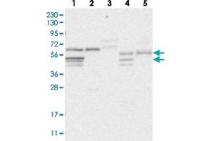 Western blot analysis of Lane 1: RT-4, Lane 2: U-251 MG, Lane 3: Human Plasma, Lane 4: Liver, Lane 5: Tonsil with CPSF3L polyclonal antibody .