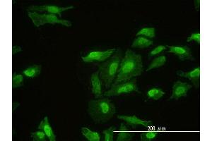 Immunofluorescence of monoclonal antibody to FHL2 on HeLa cell. (FHL2 anticorps  (AA 1-279))