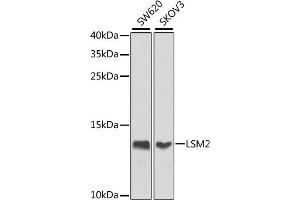 Western blot analysis of extracts of various cell lines, using LSM2 antibody (ABIN6131870, ABIN6143358, ABIN6143359 and ABIN6224004) at 1:1000 dilution. (LSM2 anticorps  (AA 1-95))