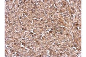 IHC-P Image Immunohistochemical analysis of paraffin-embedded RT2 xenograft, using TrxR1, antibody at 1:500 dilution. (TXNRD1 anticorps)