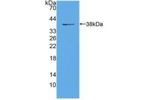 Detection of Recombinant EIF3A, Mouse using Polyclonal Antibody to Eukaryotic Translation Initiation Factor 3A (EIF3A) (EIF6 anticorps  (AA 622-848))
