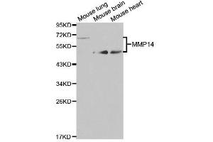 Western blot analysis of extracts of various cell lines, using MMP14 antibody. (MMP14 anticorps)