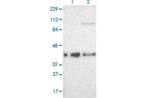 Western blot analysis of Lane 1: Human cell line RT-4 Lane 2: Human cell line U-251MG sp with CDKN1C polyclonal antibody  at 1:100-1:250 dilution. (CDKN1C anticorps)