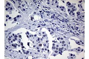 Image no. 1 for anti-Nibrin (NBN) (AA 183-460) antibody (ABIN1491067) (Nibrin anticorps  (AA 183-460))