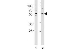 KLF4 antibody western blot analysis in (1) A431 and (2) MCF-7 lysate. (KLF4 anticorps  (AA 394-421))