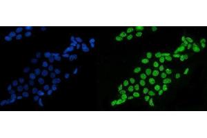 IF analysis of splicing factor 1 using anti-splicing factor 1 antibody (ABIN7600194). (Splicing Factor 1 anticorps  (AA 160-266))
