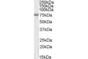 Image no. 1 for anti-Inositol-Trisphosphate 3-Kinase C (ITPKC) (Internal Region) antibody (ABIN375071) (ITPKC anticorps  (Internal Region))