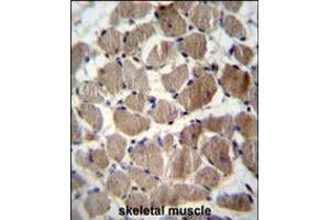 COCH Antibody immunohistochemistry analysis in formalin fixed and paraffin embedded human skeletal muscle followed by peroxidase conjugation of the secondary antibody and DAB staining. (COCH anticorps  (AA 399-428))