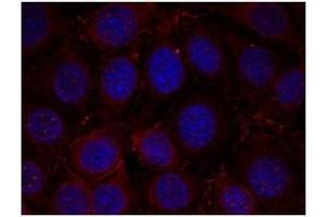Image no. 1 for anti-Insulin-Like Growth Factor 1 Receptor (IGF1R) (pTyr1165), (pTyr1166) antibody (ABIN196774) (IGF1R anticorps  (pTyr1165, pTyr1166))