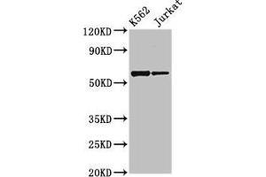 Western Blot Positive WB detected in: K562 whole cell lysate, Jurkat whole cell lysate All lanes: NAMPT antibody at 2. (NAMPT anticorps  (AA 1-280))