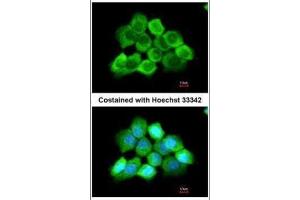 ICC/IF Image Immunofluorescence analysis of methanol-fixed A431, using AGAP3, antibody at 1:200 dilution.
