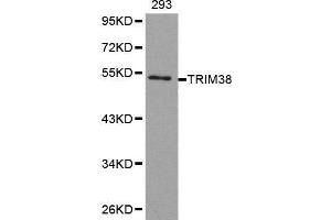 Western blot analysis of extracts of 293 cell line, using TRIM38 antibody.