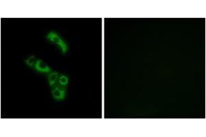 Immunofluorescence analysis of A549 cells, using C1QB Antibody.