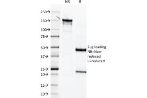 SDS-PAGE Analysis  Purified Mesothelin Mouse Monoclonal Antibody (MSLN/2131) (unconjugated). (Mesothelin anticorps  (AA 273-407) (Biotin))