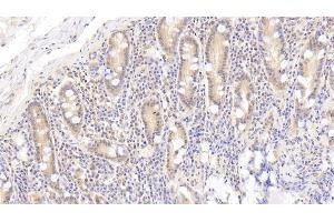 Detection of APOA4 in Human Small intestine Tissue using Polyclonal Antibody to Apolipoprotein A4 (APOA4)
