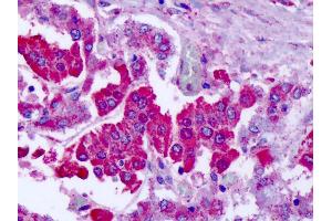 Anti-GRM7 / MGLUR7 antibody IHC of human adrenal.