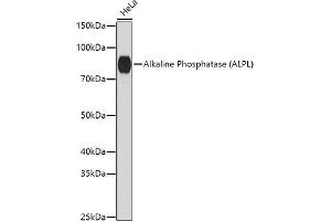 Western blot analysis of extracts of HeLa cells, using Alkaline Phosphatase (ALPL) antibody (ABIN6133557, ABIN6136824, ABIN6136825 and ABIN6216013) at 1:1000 dilution. (ALPL anticorps  (AA 150-250))