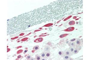 Human Placenta, Amnion: Formalin-Fixed, Paraffin-Embedded (FFPE) (TADA2L anticorps  (Internal Region))