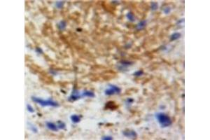 Used in DAB staining on fromalin fixed paraffin-embedded Brain tissue (Neurotrophin 3 anticorps  (AA 130-255))