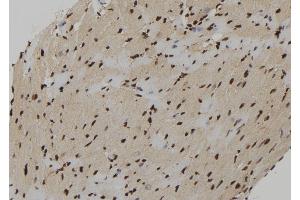 ABIN6273222 at 1/100 staining Mouse heart tissue by IHC-P. (CXXC5 anticorps)