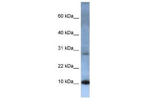 WB Suggested Anti-ATP5G2 Antibody Titration:  0. (ATP5G2 anticorps  (N-Term))