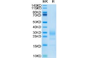 Mouse IL-5 Protein on Tris-Bis PAGE under reduced condition.