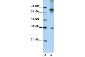 WNT9B antibody used at 5 ug/ml to detect target protein.
