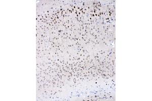 IHC analysis of IL-16 using anti-IL-16 antibody (ABIN5518927). (IL16 anticorps  (AA 1205-1322))