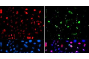 Immunofluorescence analysis of GFP-RNF168 transgenic U2OS cells using Phospho-p53(S15) Polyclonal Antibody (p53 anticorps  (pSer15))