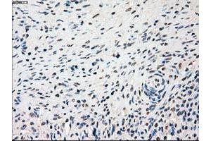 Image no. 3 for anti-Sjogren Syndrome Antigen B (SSB) antibody (ABIN1501143)