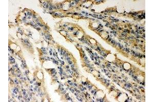 IHC-P: Rad51 antibody testing of rat intestine tissue