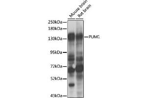 Western blot analysis of extracts of various cell lines, using PUM1 antibody (ABIN2737436) at 1:1000 dilution. (PUM1 anticorps)