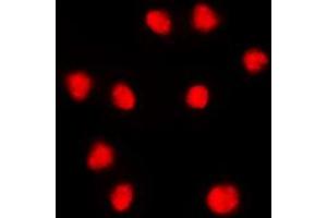 Immunofluorescent analysis of FOXC1/2 staining in THP1 cells. (FOXC1 anticorps  (Center))