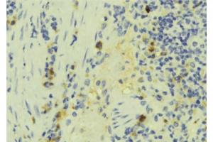 ABIN6272891 at 1/100 staining Human lymph tissue by IHC-P. (IFT57 anticorps  (Internal Region))